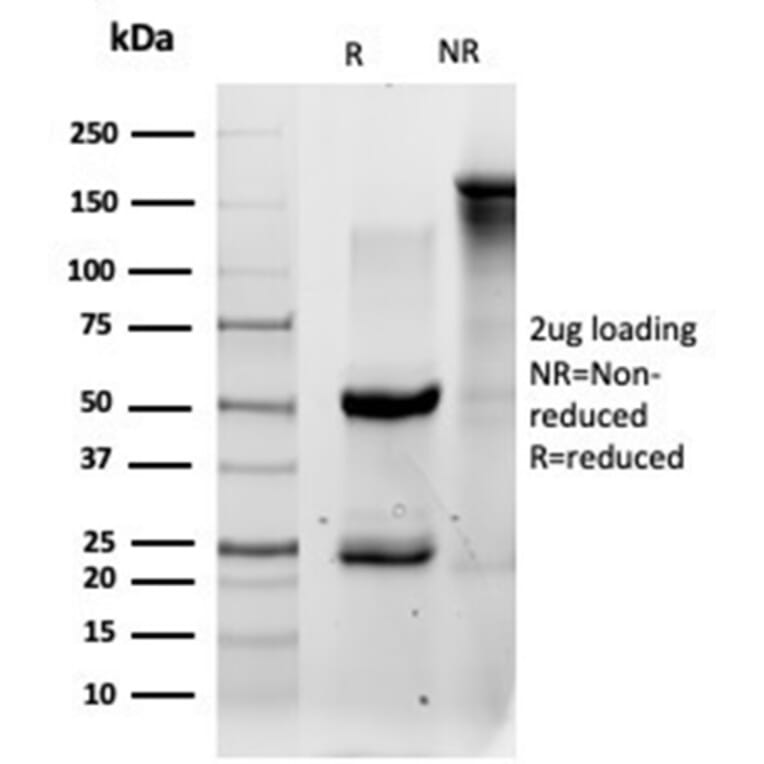 SDS-PAGE - Anti-QKI Antibody [PCRP-QKI-2F10] - BSA and Azide free (A278440) - Antibodies.com