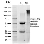 SDS-PAGE - Anti-QKI Antibody [PCRP-QKI-2F10] - BSA and Azide free (A278440) - Antibodies.com