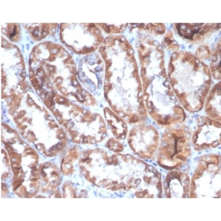 Immunohistochemistry - Anti-CD40L Antibody [CD40LG/4675] - BSA and Azide free (A278444) - Antibodies.com