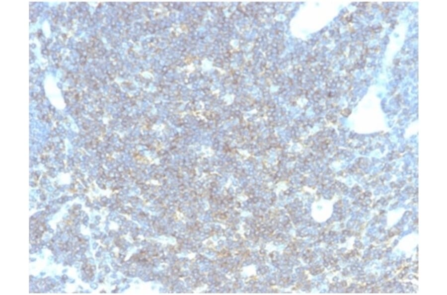 Immunohistochemistry - Anti-CD48 Antibody [CD48/4783] - BSA and Azide free (A278445) - Antibodies.com