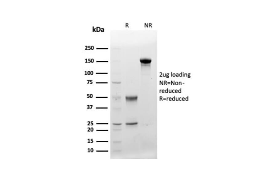 Protein Array - Anti-CD48 Antibody [CD48/4783] - BSA and Azide free (A278445) - Antibodies.com
