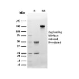 Protein Array - Anti-CD48 Antibody [CD48/4783] - BSA and Azide free (A278445) - Antibodies.com