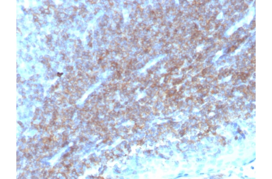 Immunohistochemistry - Anti-CD48 Antibody [CD48/4784] - BSA and Azide free (A278446) - Antibodies.com