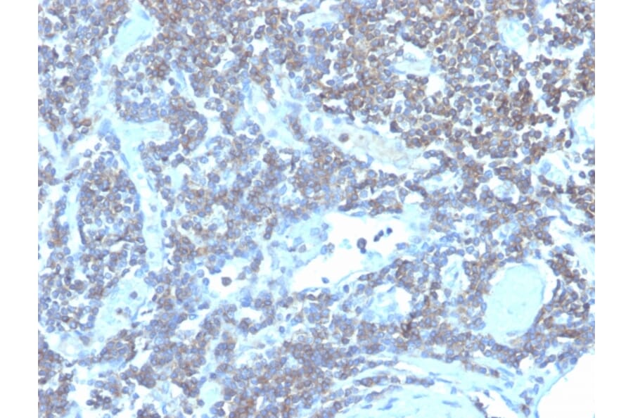 Immunohistochemistry - Anti-CD48 Antibody [CD48/4784] - BSA and Azide free (A278446) - Antibodies.com
