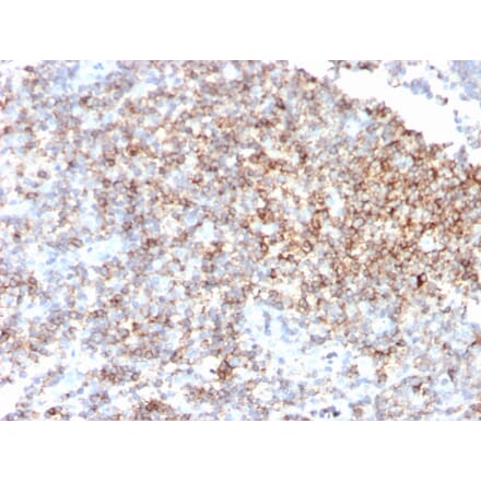 Immunohistochemistry - Anti-CD48 Antibody [CD48/4785] - BSA and Azide free (A278447) - Antibodies.com