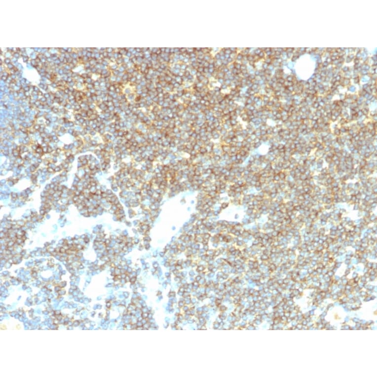Immunohistochemistry - Anti-CD48 Antibody [CD48/4785] - BSA and Azide free (A278447) - Antibodies.com