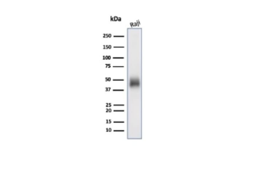 Western Blot - Anti-CD48 Antibody [CD48/4785] - BSA and Azide free (A278447) - Antibodies.com