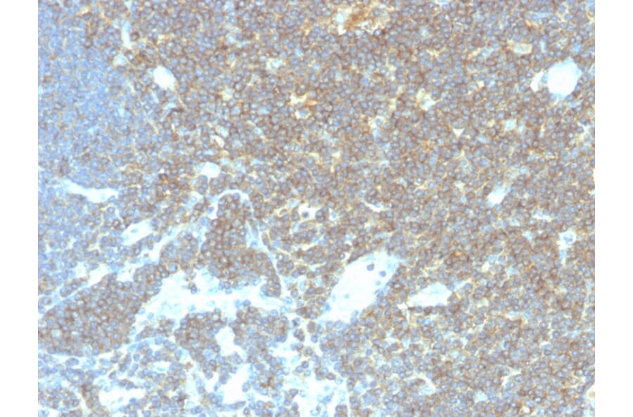 Immunohistochemistry - Anti-CD48 Antibody [CD48/4786] - BSA and Azide free (A278448) - Antibodies.com