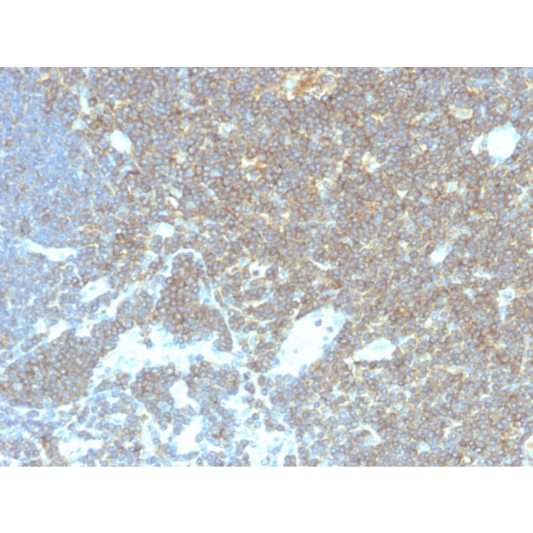 Immunohistochemistry - Anti-CD48 Antibody [CD48/4786] - BSA and Azide free (A278448) - Antibodies.com