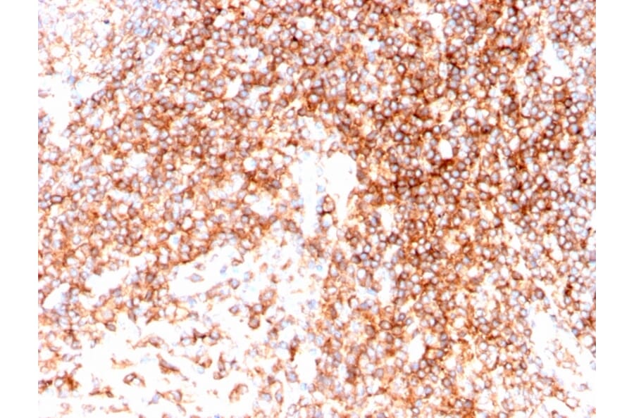 Immunohistochemistry - Anti-CD48 Antibody [CD48/4786] - BSA and Azide free (A278448) - Antibodies.com