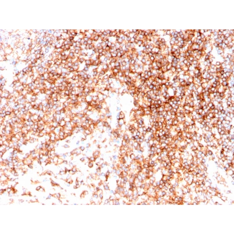 Immunohistochemistry - Anti-CD48 Antibody [CD48/4786] - BSA and Azide free (A278448) - Antibodies.com