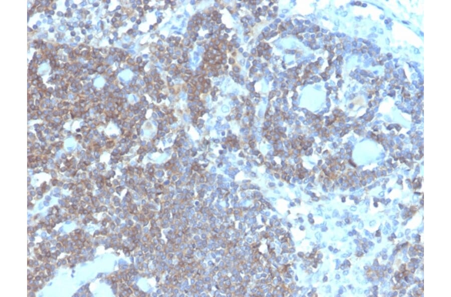 Immunohistochemistry - Anti-CD48 Antibody [CD48/4787] - BSA and Azide free (A278449) - Antibodies.com
