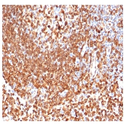 Immunohistochemistry - Anti-CD74 Antibody [CLIP/6609] - BSA and Azide free (A278451) - Antibodies.com