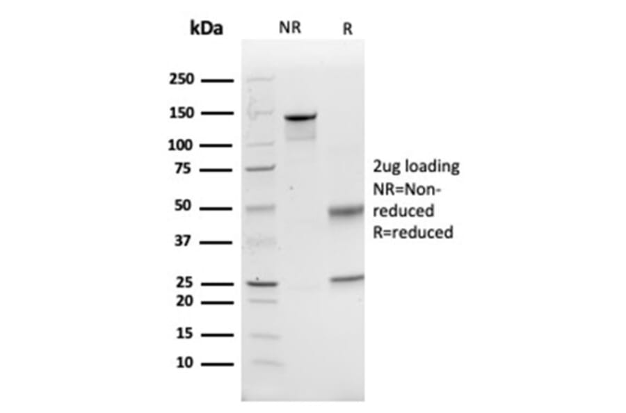 SDS-PAGE - Anti-CD74 Antibody [CLIP/6609] - BSA and Azide free (A278451) - Antibodies.com
