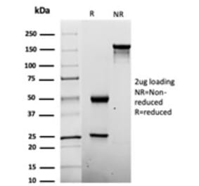 SDS-PAGE - Anti-Penicillin Antibody [Pen-9] - BSA and Azide free (A278452) - Antibodies.com