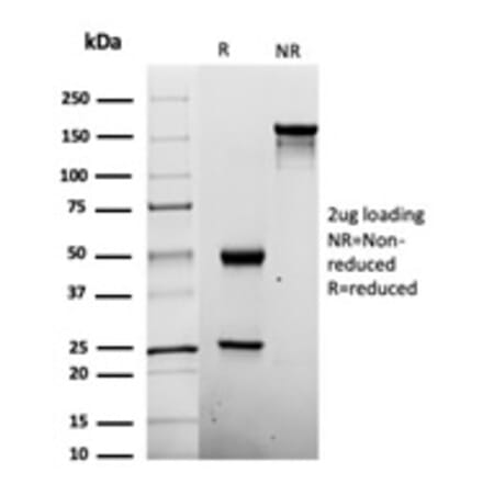 SDS-PAGE - Anti-Penicillin Antibody [Pen-9] - BSA and Azide free (A278452) - Antibodies.com