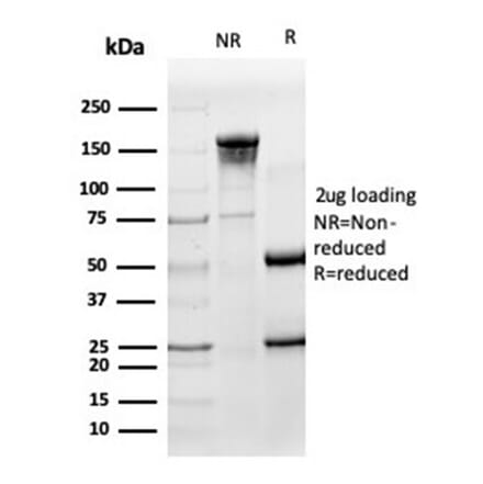 SDS-PAGE - Anti-HA Tag Antibody [HA/279] - BSA and Azide free (A278453) - Antibodies.com
