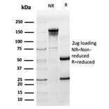 SDS-PAGE - Anti-HA Tag Antibody [HA/279] - BSA and Azide free (A278453) - Antibodies.com