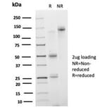 SDS-PAGE - Anti-IRF3 Antibody [PCRP-IRF3-3B2] - BSA and Azide free (A278458) - Antibodies.com