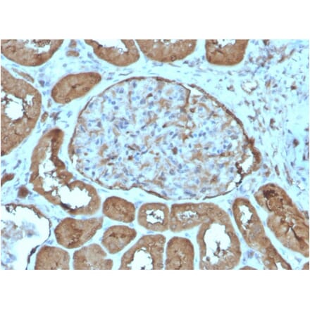 Immunohistochemistry - Anti-Laminin gamma 1 Antibody [LAMC1/3162] - BSA and Azide free (A278459) - Antibodies.com