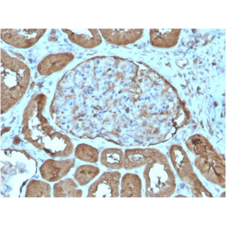 Immunohistochemistry - Anti-Laminin gamma 1 Antibody [LAMC1/3162] - BSA and Azide free (A278459) - Antibodies.com