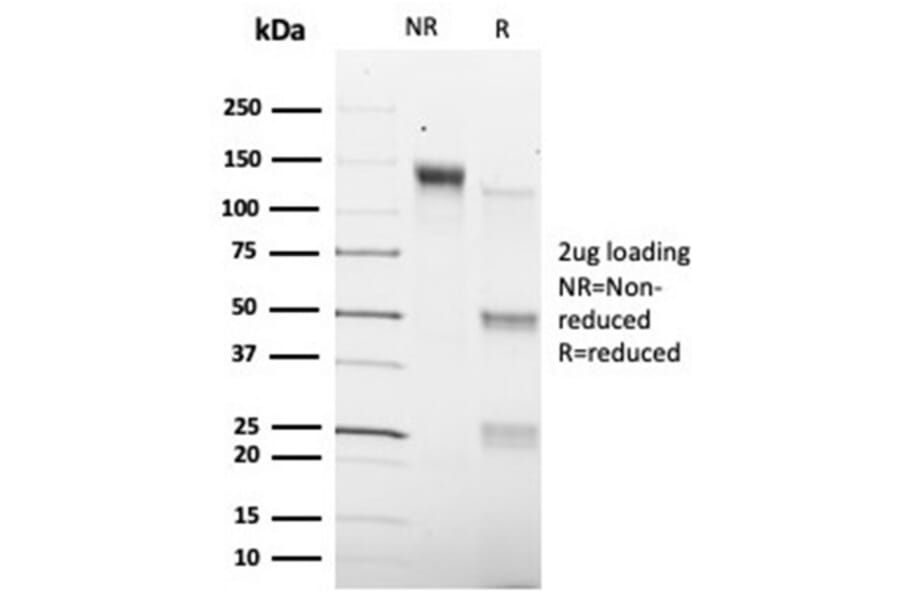 SDS-PAGE - Anti-SMAD9 Antibody [PCRP-SMAD9-2F4] - BSA and Azide free (A278460) - Antibodies.com