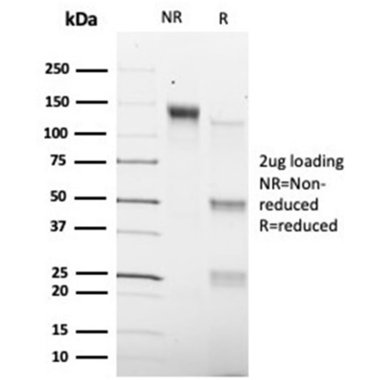 SDS-PAGE - Anti-SMAD9 Antibody [PCRP-SMAD9-2F4] - BSA and Azide free (A278460) - Antibodies.com