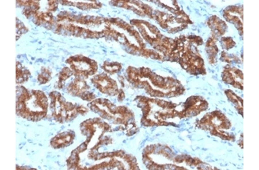 Immunohistochemistry - Anti-AMACR Antibody [13H4] - BSA and Azide free (A278461) - Antibodies.com