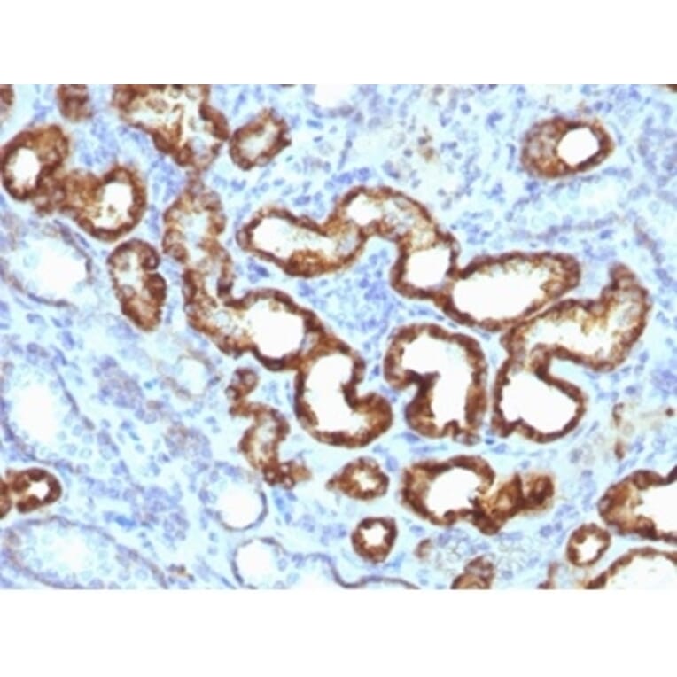 Immunohistochemistry - Anti-AMACR Antibody [13H4] - BSA and Azide free (A278461) - Antibodies.com