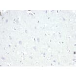 Immunohistochemistry - Anti-AMACR Antibody [13H4] - BSA and Azide free (A278461) - Antibodies.com