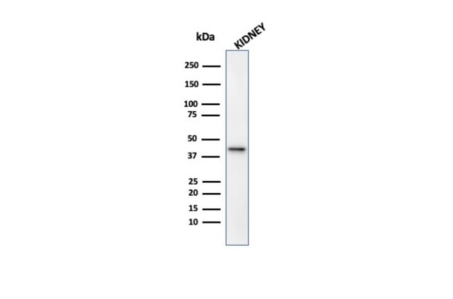 Western Blot - Anti-AMACR Antibody [13H4] - BSA and Azide free (A278461) - Antibodies.com