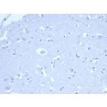 Immunohistochemistry - Anti-p21 Antibody [rCIP1/6907] - BSA and Azide free (A278464) - Antibodies.com