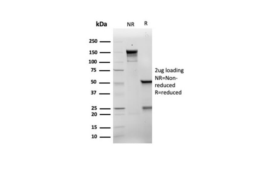 SDS-PAGE - Anti-p21 Antibody [rCIP1/6907] - BSA and Azide free (A278464) - Antibodies.com