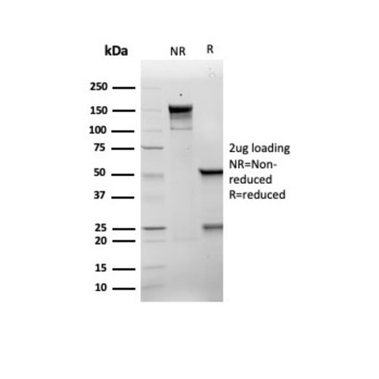 SDS-PAGE - Anti-p21 Antibody [rCIP1/6907] - BSA and Azide free (A278464) - Antibodies.com