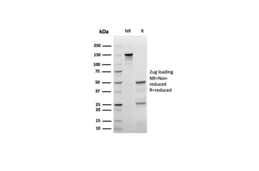 SDS-PAGE - Anti-p27 Kip1 Antibody [rKIP1/1356] - BSA and Azide free (A278465) - Antibodies.com