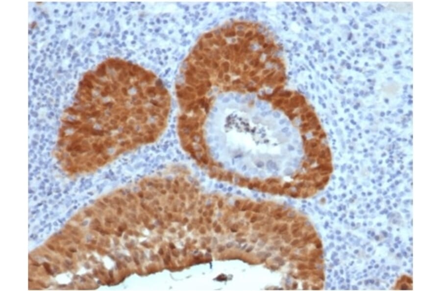 Immunohistochemistry - Anti-p16INK4a Antibody [rCDKN2A/4845] - BSA and Azide free (A278466) - Antibodies.com