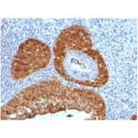Immunohistochemistry - Anti-p16INK4a Antibody [rCDKN2A/4845] - BSA and Azide free (A278466) - Antibodies.com