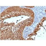 Immunohistochemistry - Anti-p16INK4a Antibody [rCDKN2A/4845] - BSA and Azide free (A278466) - Antibodies.com