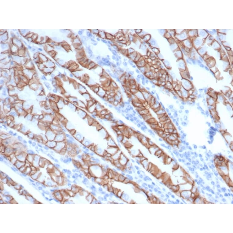 Immunohistochemistry - Anti-delta 1 Catenin Antibody [rCTNND1/6903] - BSA and Azide free (A278470) - Antibodies.com