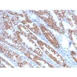 Immunohistochemistry - Anti-delta 1 Catenin Antibody [rCTNND1/6903] - BSA and Azide free (A278470) - Antibodies.com