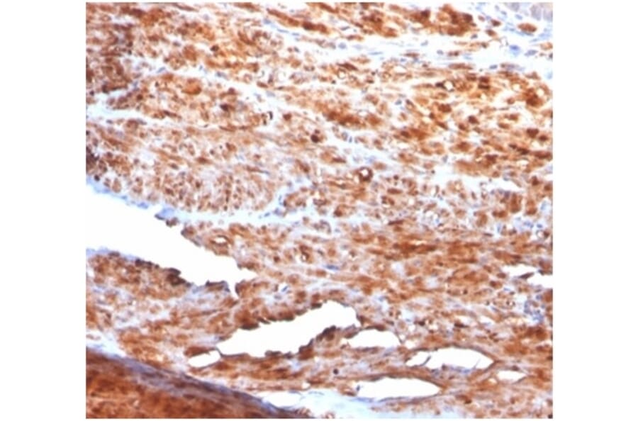 Immunohistochemistry - Anti-Desmin Antibody [rDES/1711] - BSA and Azide free (A278471) - Antibodies.com