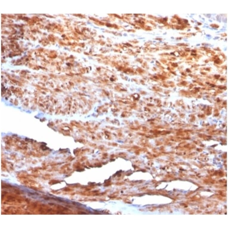 Immunohistochemistry - Anti-Desmin Antibody [rDES/1711] - BSA and Azide free (A278471) - Antibodies.com