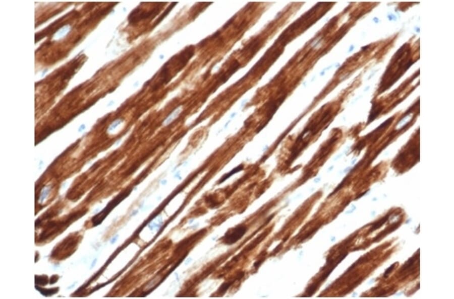 Immunohistochemistry - Anti-Desmin Antibody [rDES/1711] - BSA and Azide free (A278471) - Antibodies.com