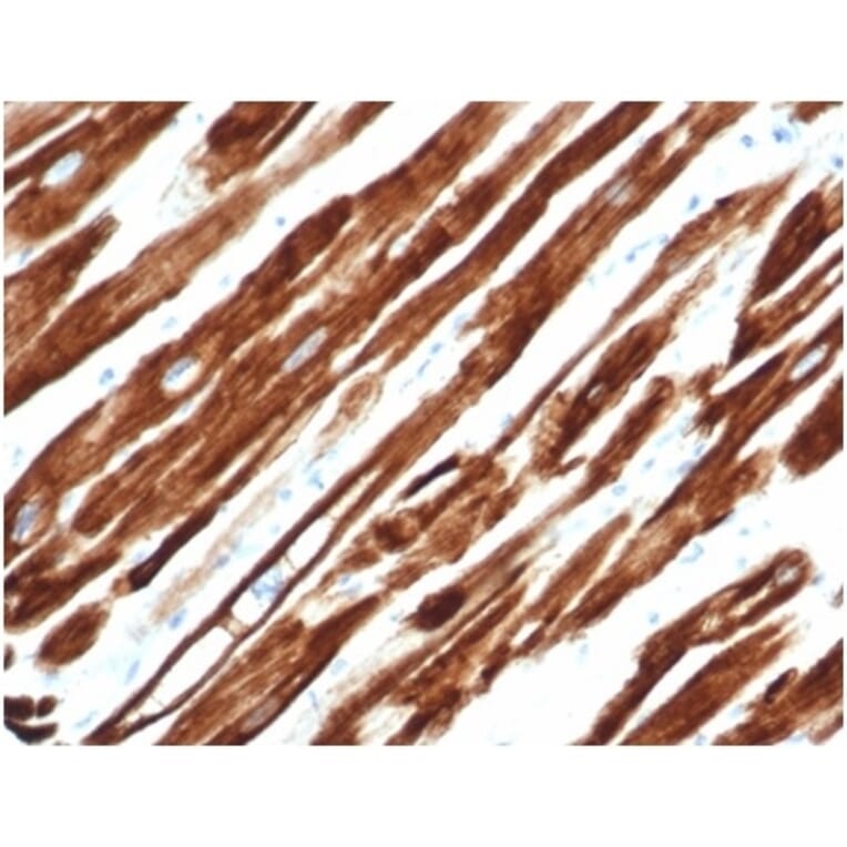 Immunohistochemistry - Anti-Desmin Antibody [rDES/1711] - BSA and Azide free (A278471) - Antibodies.com