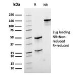 SDS-PAGE - Anti-Desmin Antibody [rDES/1711] - BSA and Azide free (A278471) - Antibodies.com