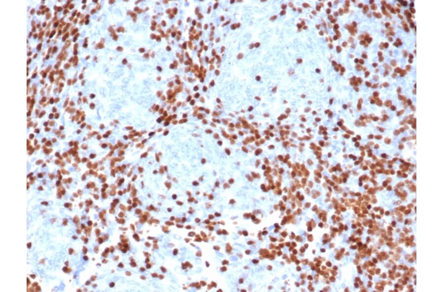 Immunohistochemistry - Anti-TdT Antibody [rDNTT/6909] - BSA and Azide free (A278472) - Antibodies.com