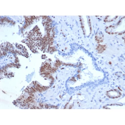 Immunohistochemistry - Anti-ERG Antibody [rERG/6843] - BSA and Azide free (A278473) - Antibodies.com