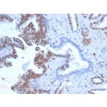 Immunohistochemistry - Anti-ERG Antibody [rERG/6843] - BSA and Azide free (A278473) - Antibodies.com