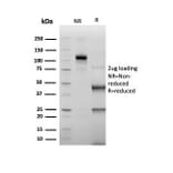 SDS-PAGE - Anti-ERG Antibody [rERG/6843] - BSA and Azide free (A278473) - Antibodies.com