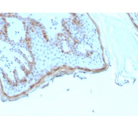 Immunohistochemistry - Anti-Filaggrin Antibody [rFLG/1945] - BSA and Azide free (A278474) - Antibodies.com